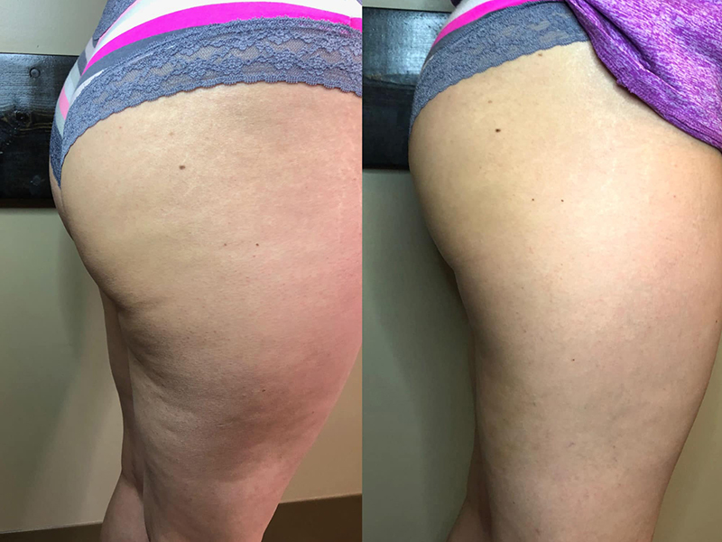 Keter_Medical_Center___Spa_body_Treatments_ b___a_02