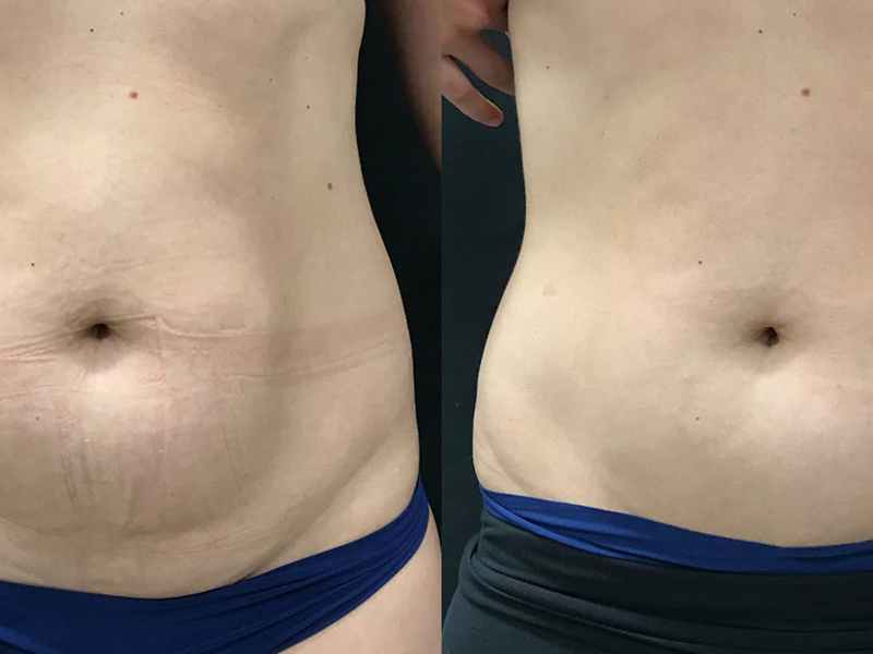 Keter_Medical_Center___Spa_body_Treatments_ b___a_04